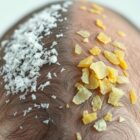 Łupież suchy czy tłusty: jak rozpoznać różnice i dobrać skuteczną pielęgnację skóry głowy